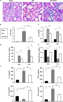 Resolvin D1 Protects Against Ischemia/Reperfusion-Induced Acute Kidney Injury by Increasing Treg Percentages via the ALX/FPR2 Pathway